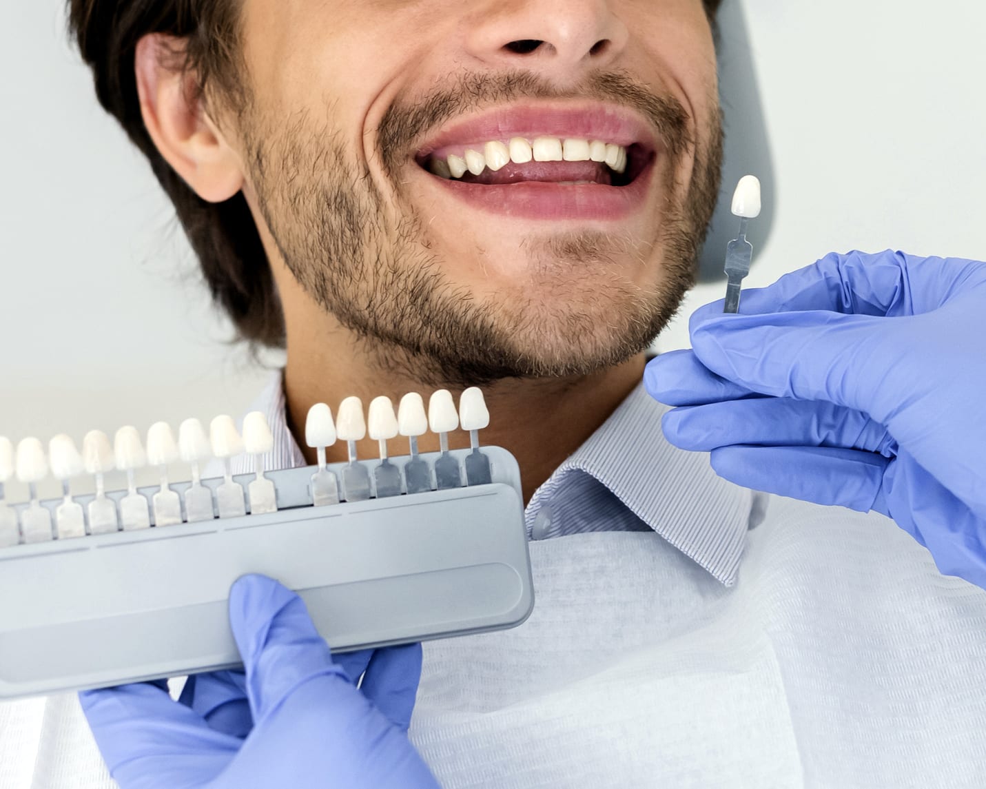 Teeth Whitening - Govan Dental Care